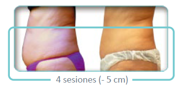 CASO_3